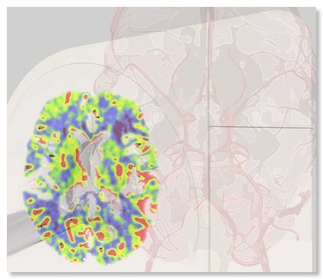 arterias_transparent