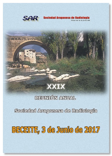 XXIXBeceite2017