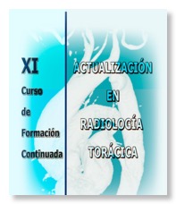 Curso11_TORact copia