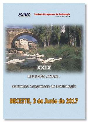 XXIXBeceite2017