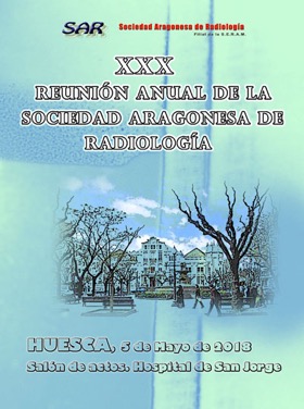 XXXHuesca1